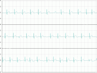 心电图 - category-work,grid,series-line